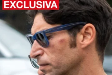 Primeras fotos de la salida del hospital de Cayetano Rivera mostrando golpes en la cara y una rodilla, tras su detención