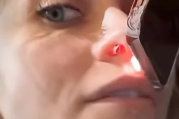 Paris Jackson muestra la lesión que le ha provocado el consumo de cocaína en el tabique nasal: estos son los duros efectos de la droga