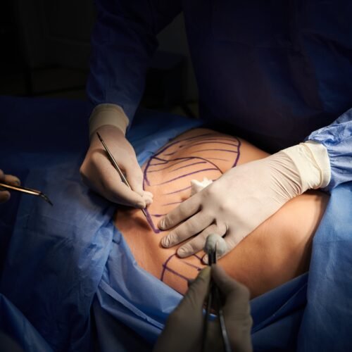 Sanidad veta las cirugías estéticas a los médicos que no tengan la especialidad