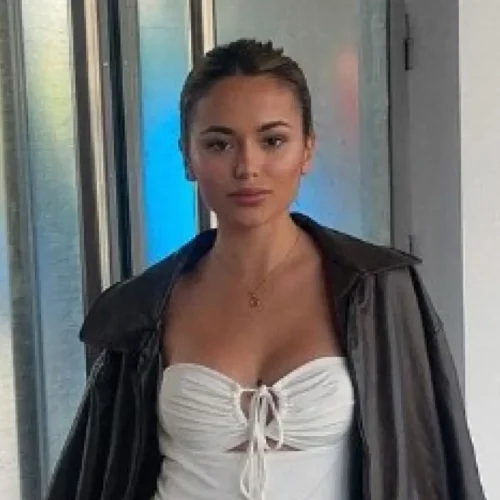 Gal·la, de ‘La isla de las tentaciones’, tras quitarse el ácido hialurónico: «No sabía que me iba a quedar así»