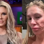 El calvario de una ‘influencer’ de EEUU: tres años de pruebas y sigue sin saber por qué su cara se deformó