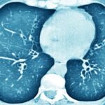 ARN de transferencia, un mismo tratamiento pionero para decenas de enfermedades genéticas