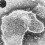 Identifican los tres primeros casos de bronquiolitis por una mutación del VRS que desafía al tratamiento que protege a los bebés