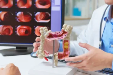 Las bacterias del intestino dejan una pista sobre algunos cánceres que aparecen antes de los 50 años