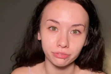 Brutal agresión en plena calle a la ‘influencer’ María Reus Huang, que acaba en urgencias y muestra las heridas: «Sigo sin entenderlo»